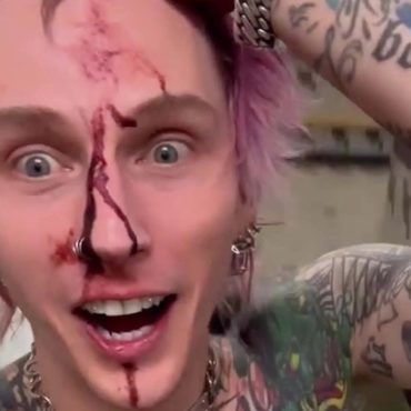 machine-gun-kelly-shows-off-bloody-face-after-smashing-a-glass-on-his-forehead-again