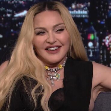 madonna-painful-facelift-revealed-to-fans